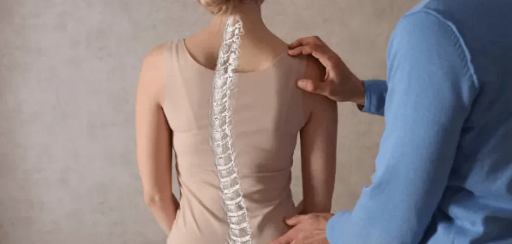 Living with the Outcomes of Spine Surgery
