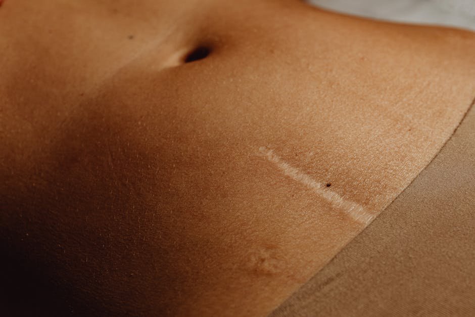 Navigating Recovery After a Tummy Tuck