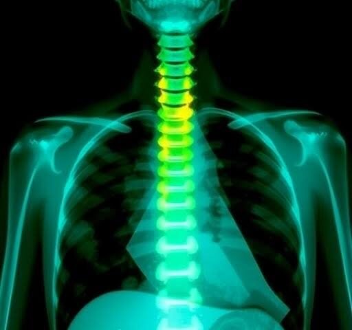 How Spine Neurosurgeons Approach Complex Spine Cases