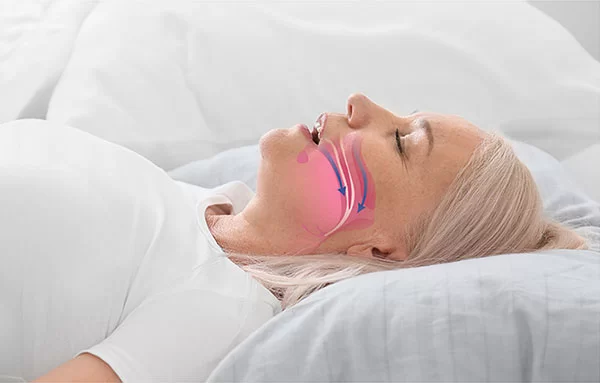 Identifying the Signs of Sleep Apnea