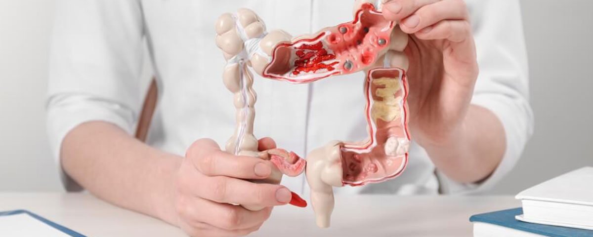 The Role of Gastroenterology in Preventative Health