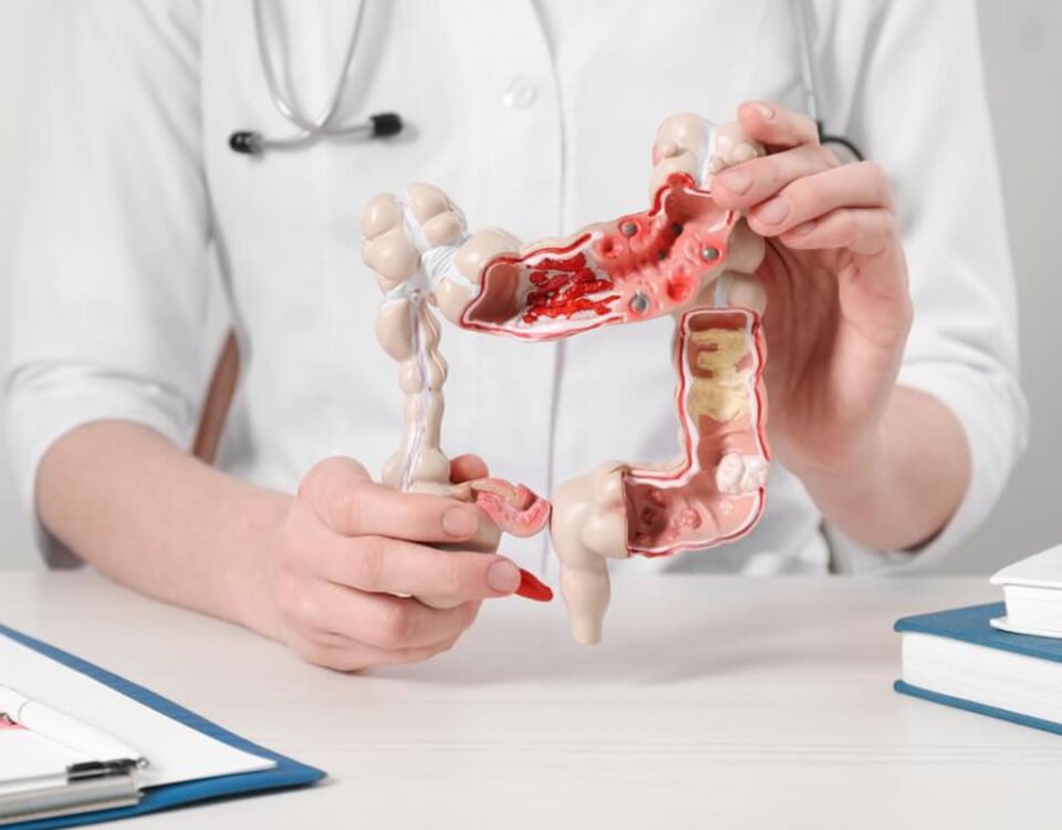 The Role of Gastroenterology in Preventative Health