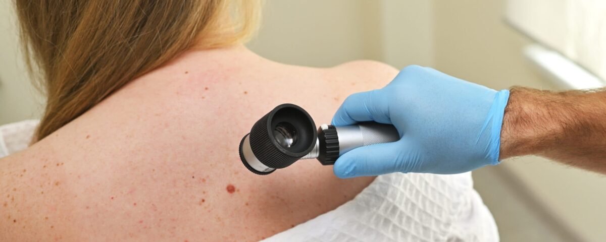 The Role of Regular Check-Ups for Melanoma Prevention