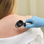 The Role of Regular Check-Ups for Melanoma Prevention