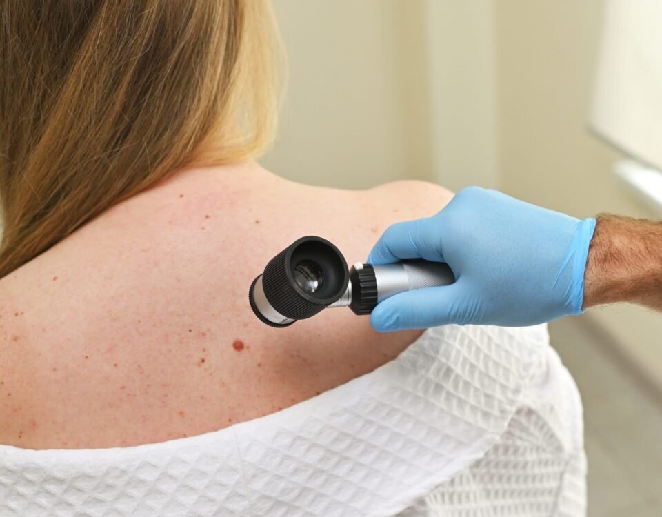 The Role of Regular Check-Ups for Melanoma Prevention