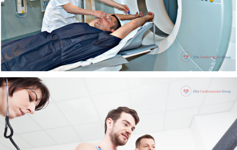 The Significance of Nuclear Stress Testing in Heart Disease Diagnosis