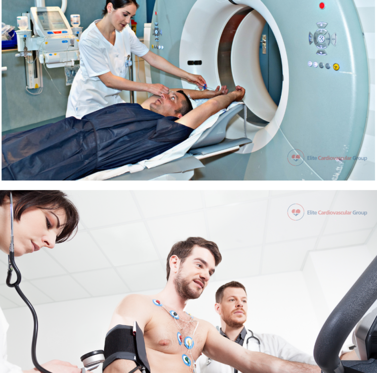 The Significance of Nuclear Stress Testing in Heart Disease Diagnosis