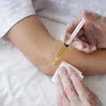 How PRP Therapy Can Enhance Athletic Performance