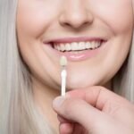 How To Customize Your Porcelain Veneers