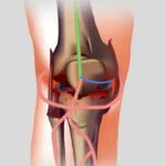 What You Need To Know About Knee Pain